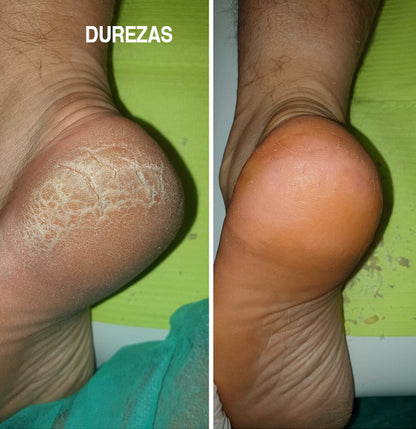 DermaFeet Pro™ Lima Eléctrica Recargable